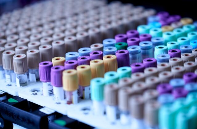 Beckman Coulter Analyzer